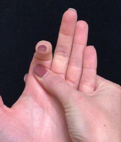 The other hand supports the finger just below the middle joint while it bends and straightens.